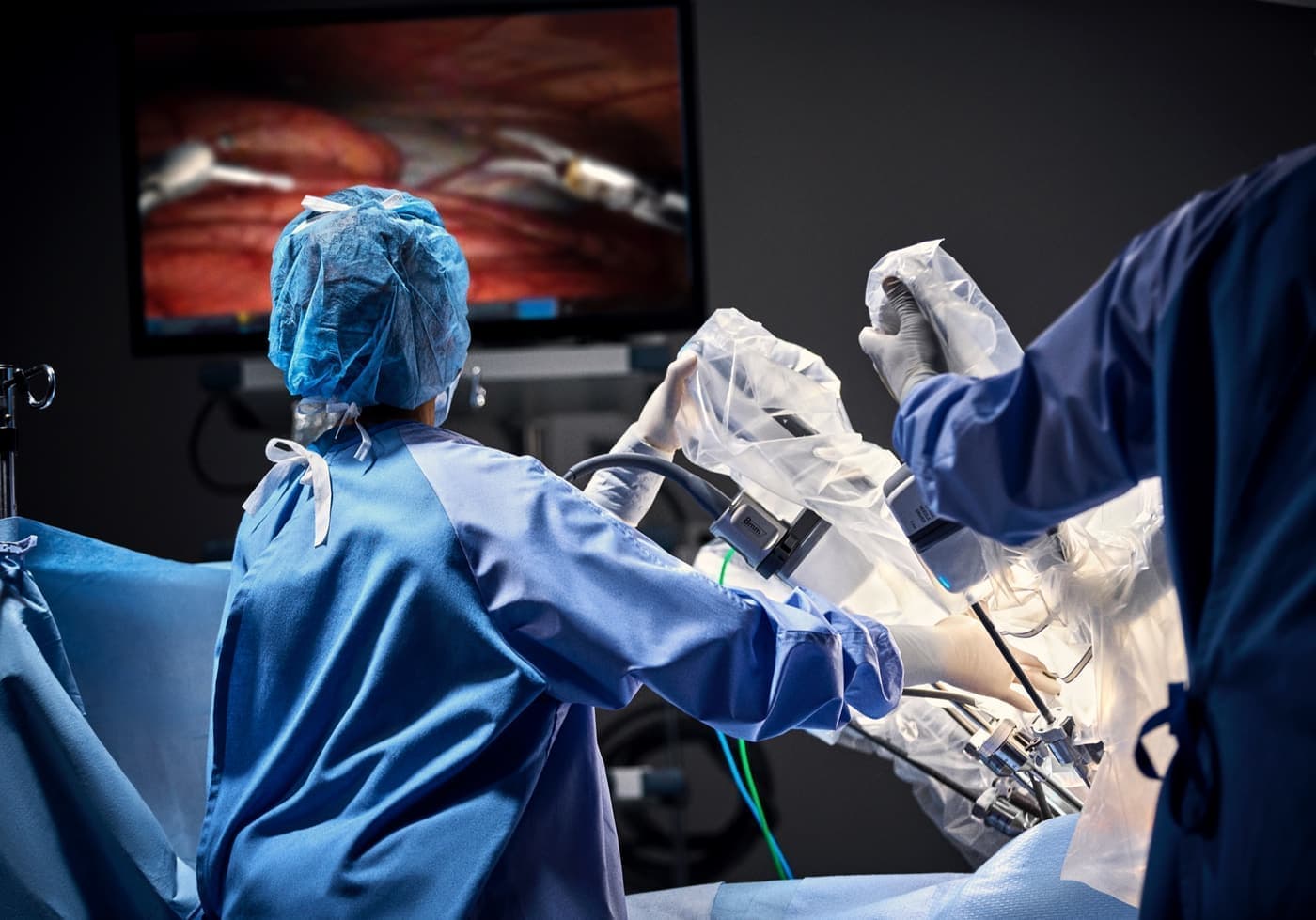 Surgical team with da Vinci vision cart in the operating room
